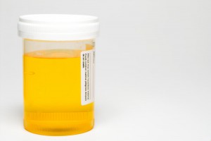 urine-smells-like-sulfur