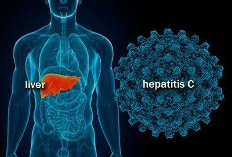 hepatitis_c