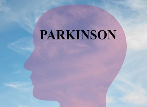 Parkinson concept